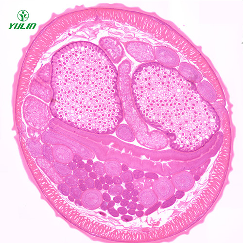 四川蛔虫（雌）