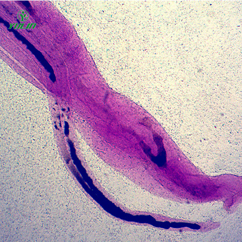 四川日本血吸虫雌雄合抱装片
