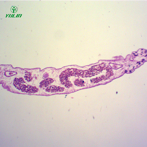 四川医学蠕虫吸虫生物切片