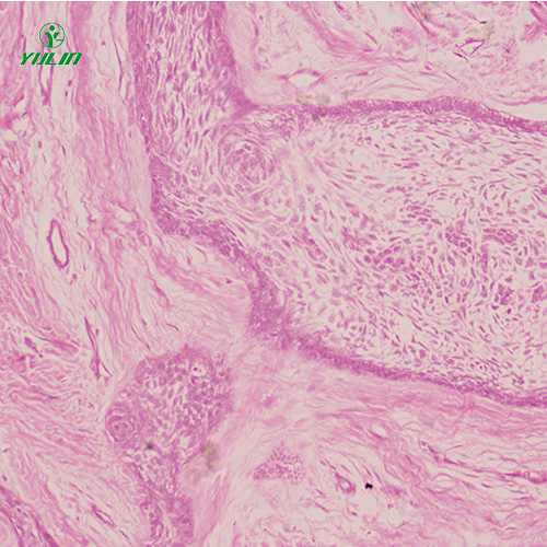 四川人口腔病理标本片