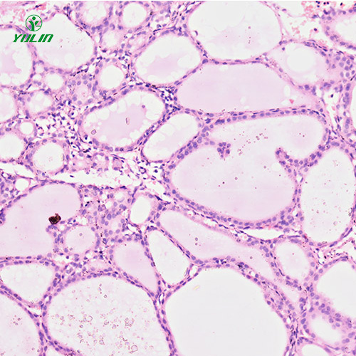 四川人内分泌系统疾病标本片