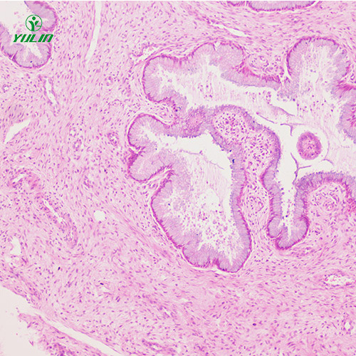 四川人泌尿生殖系统疾病标本片