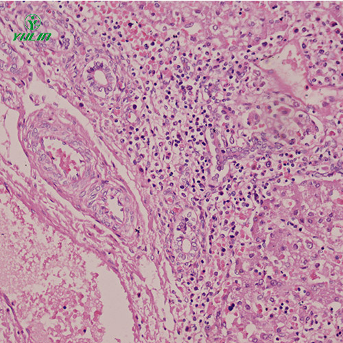 四川人消化系统疾病标本片