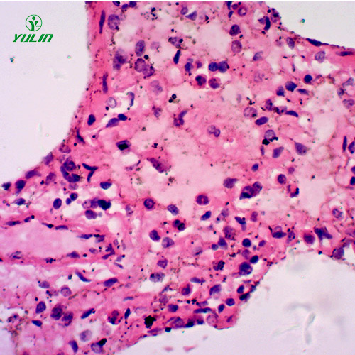四川人呼吸系统疾病标本片