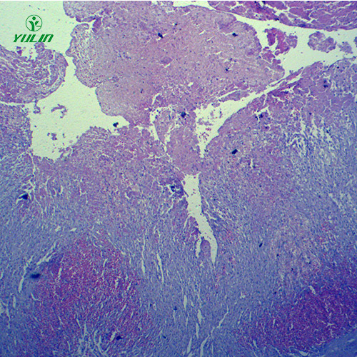 四川人体局部血液循环障碍病理玻片
