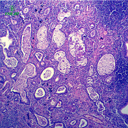 四川炎症病理玻片
